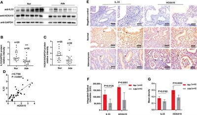 Decreased intracellular IL-33 impairs endometrial receptivity in women with adenomyosis
